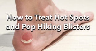 How to Treat Hot Spots and Pop Hiking Blisters